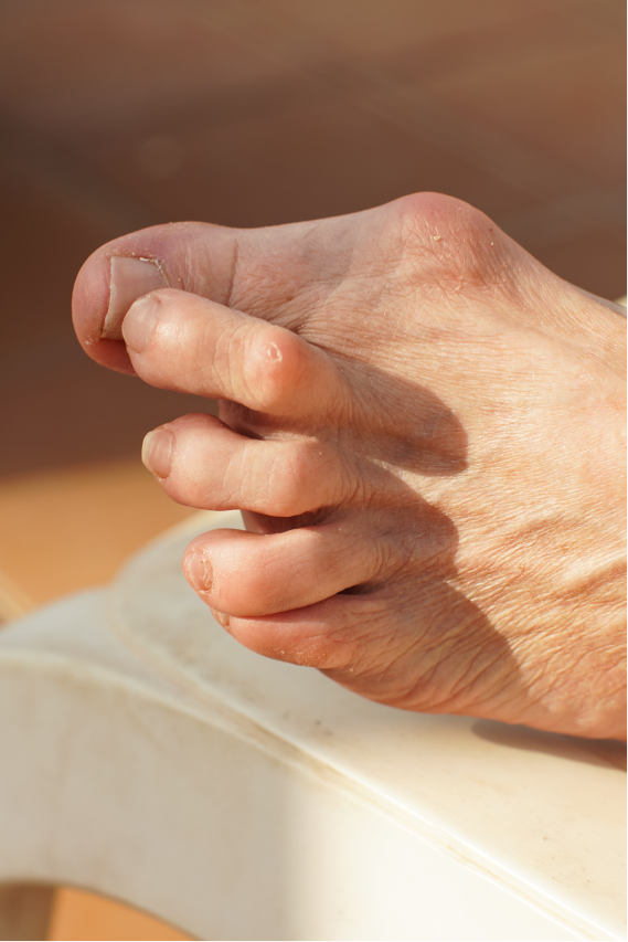 Bunions and Big Toe Mobility Digital Course
